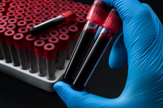 Phlebotomy Career Training: Announcing an expansion to our phlebotomy course