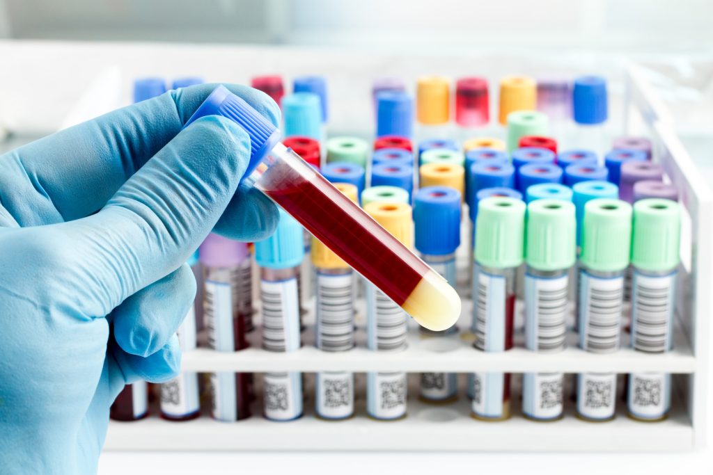 Phlebotomy Jobs in New York